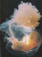 Foetus. Document Discover.