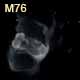 dessin nebuleuse planetaire M76